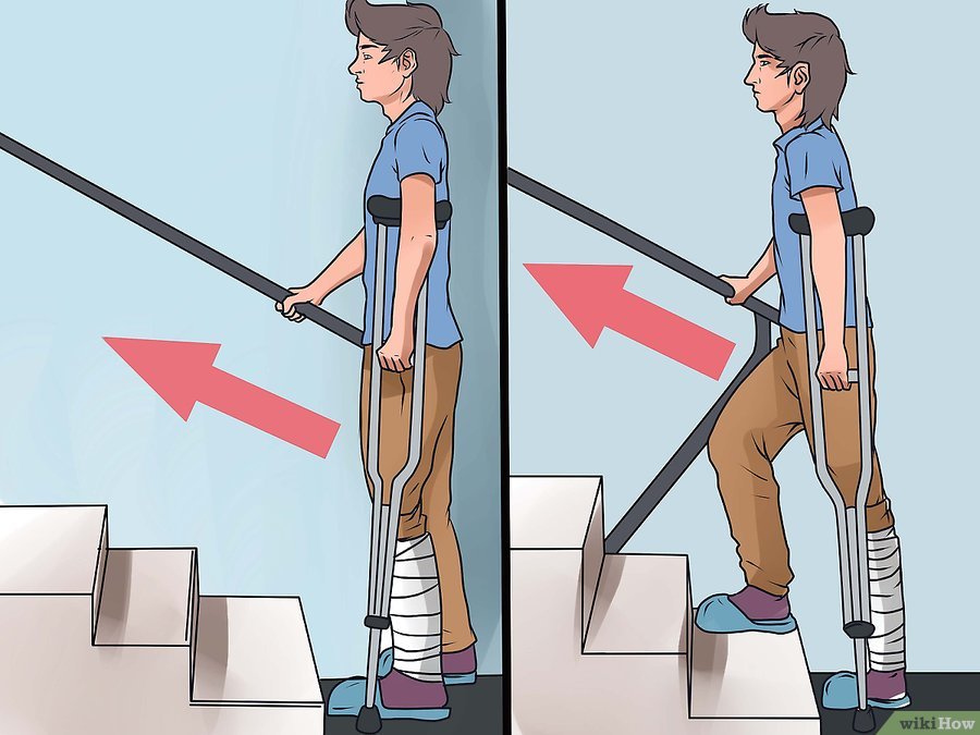 Как правильно ходить по ступеньках на костылях